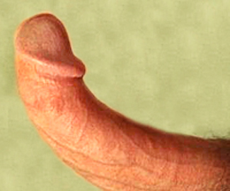 straighten a bent penis