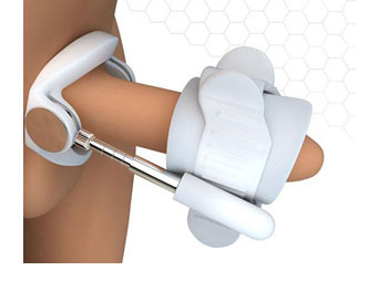 penis traction device, peyronies disease, erectile dysfunction symptoms