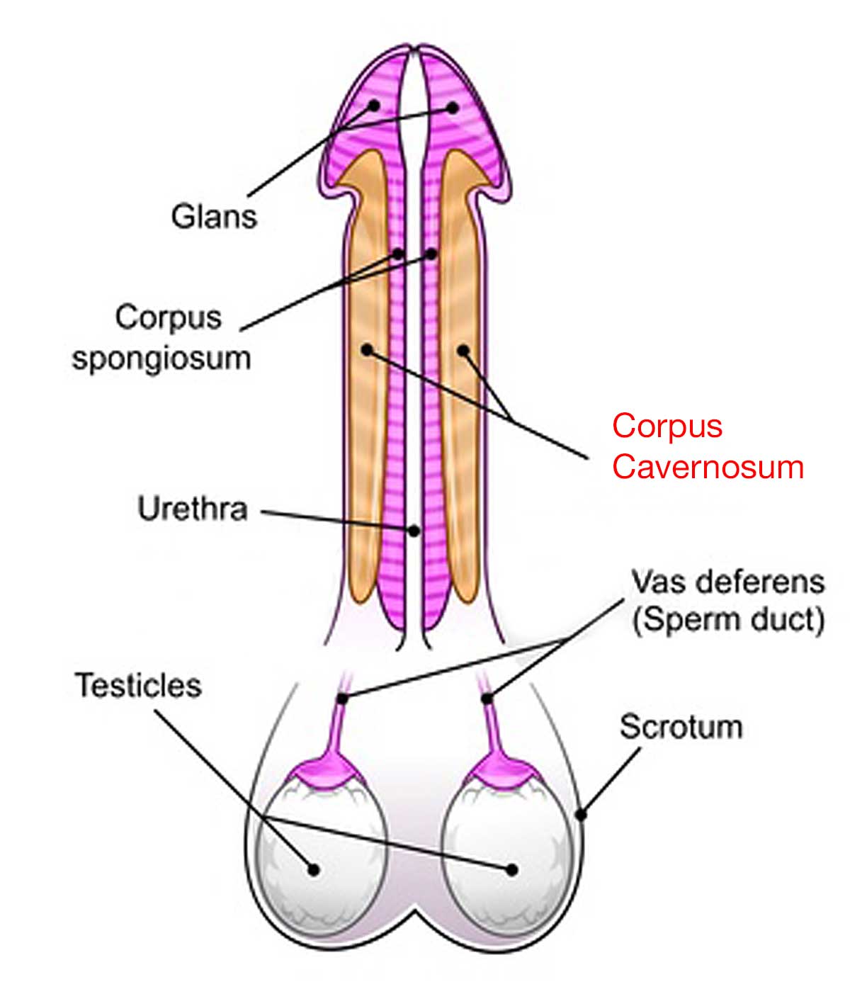 corpus cavernosum, peyronies disease, bent penis