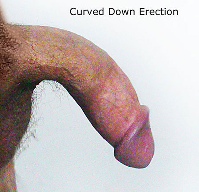 Curved Down Penis Pictures. 