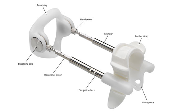 penis traction device used for peyronies disease treatments