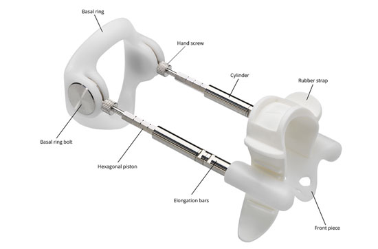 penis lengthening with a traction device